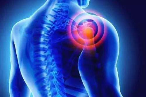 如何区分肩袖损伤和肩周炎？